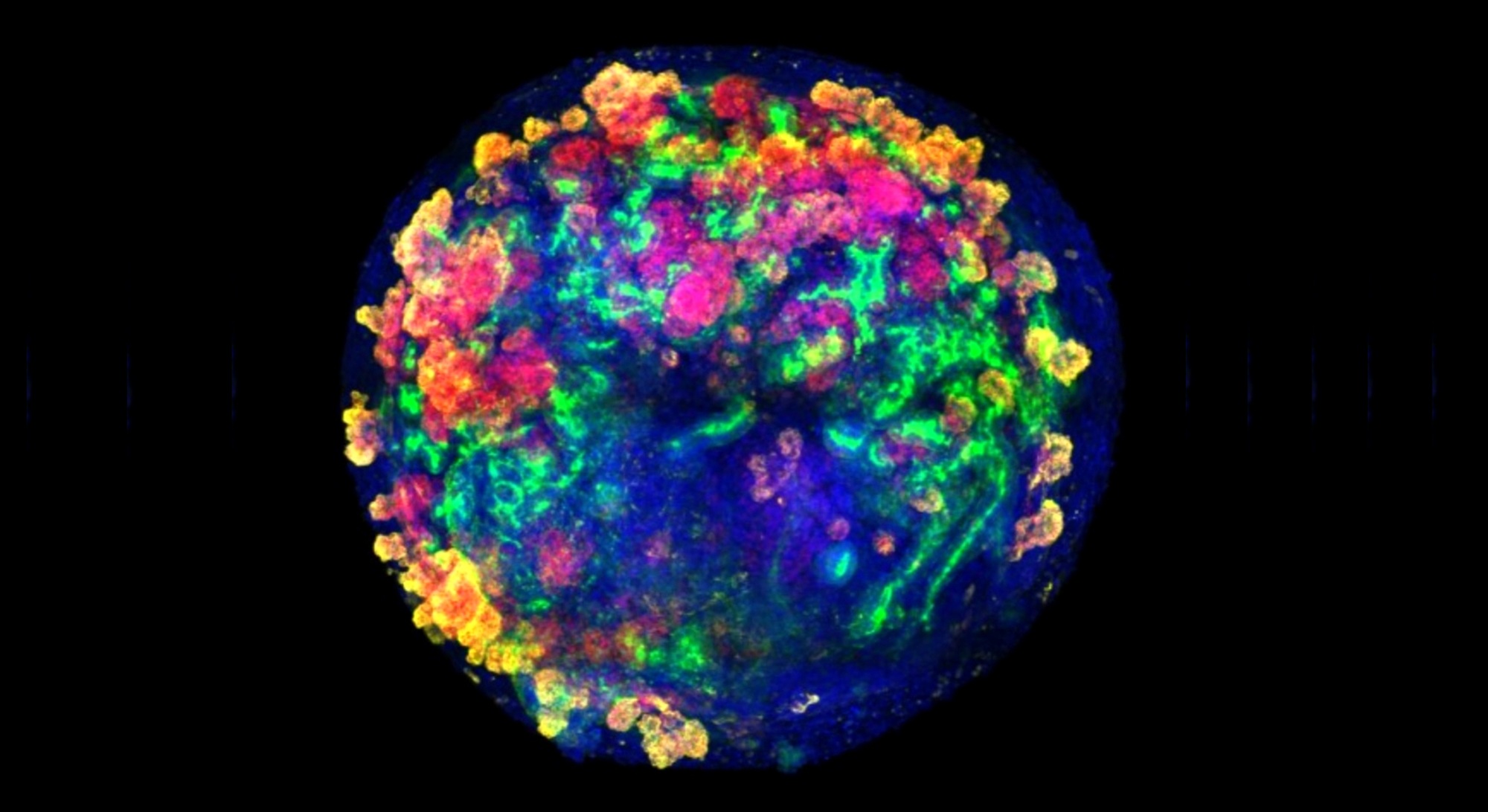 Imagen de uno de los organoides humanos utilizados en la investigación para el autotrasplante con riñones de cerdo ((IBEC).