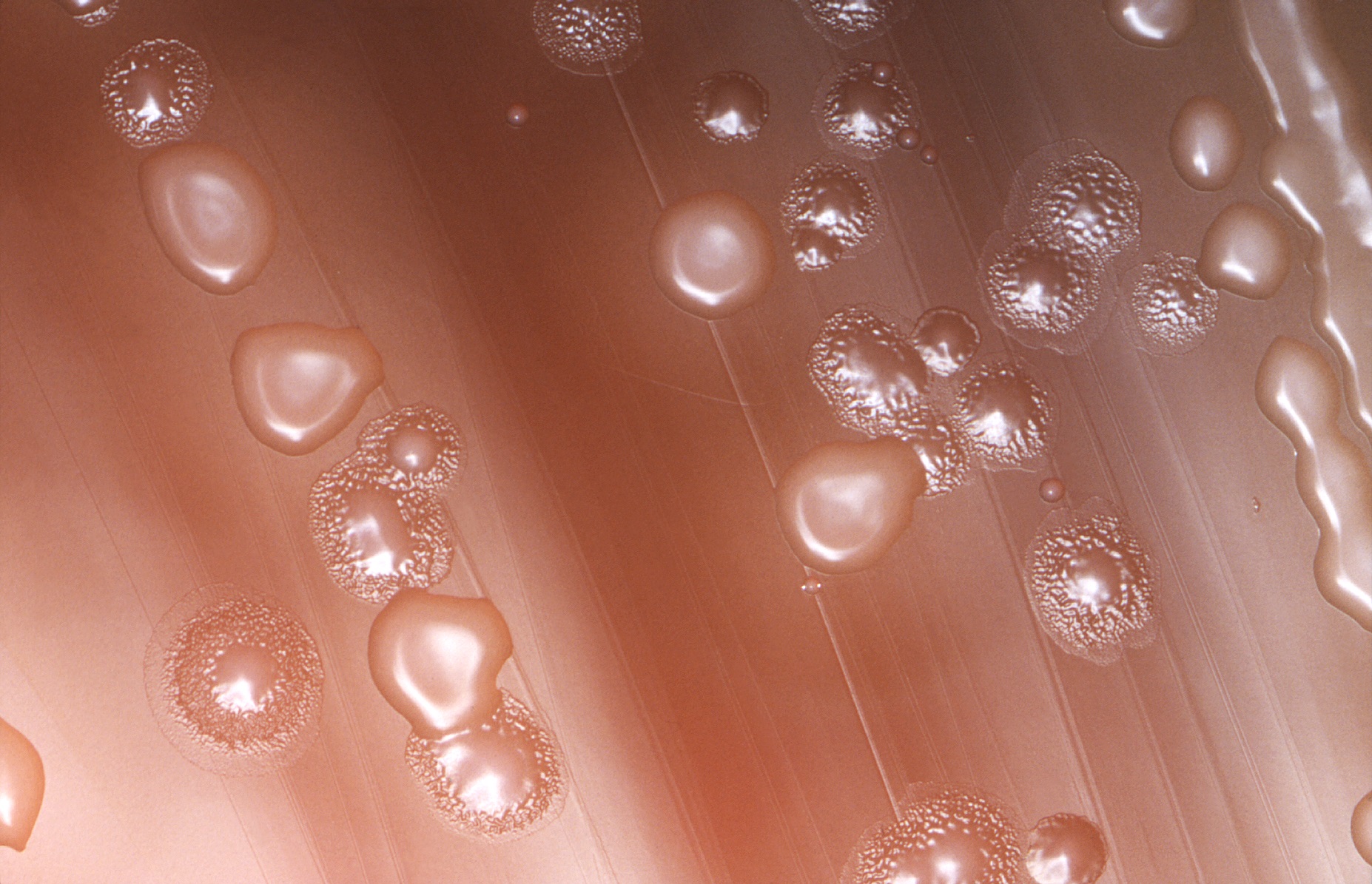 Colonias de 'Streptococcus pneumoniae', o neumococo, bacteria causante de la mayoría de neumonías que se producen en comunidad.