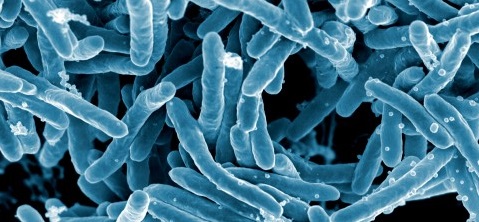 Micrografía electrónica de <em>Mycobacterium tuberculosis</em>, bacteria causante de la enfermedad (imagen: NIH/NIAID).